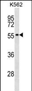 POLR1E Antibody (Center)