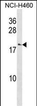 CCL27 Antibody (C-term)