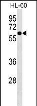 ZNF649 Antibody (N-term)