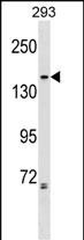 NCAPG2 Antibody (Center)