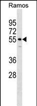 IQCB1 Antibody (Center)