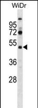 SUPT7L Antibody (Center)