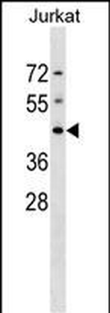 DHPS Antibody (N-term)