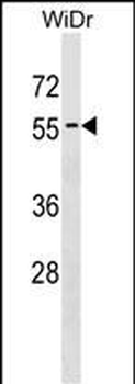 APG4D Antibody (Center S341)