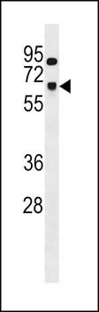 SNRNP70 Antibody (Center)