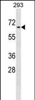 PTPN5 Antibody (N-term)