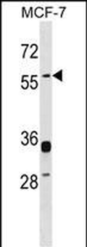 ERVWE1 Antibody (C-term)
