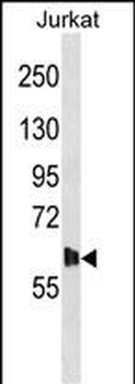 DMPK Antibody (N-term)