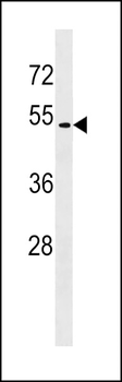 GPR171 Antibody (C-term)