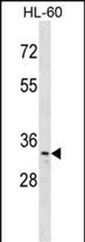 TP53RK Antibody (C-term)