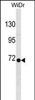 RPN1 Antibody (C-term)