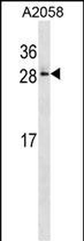 RAB28 Antibody (Center)