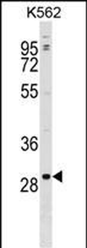 POLR3G Antibody (C-term)