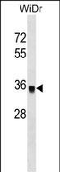 PPP1CC Antibody (C-term)
