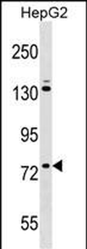 ZNF540 Antibody (N-term)