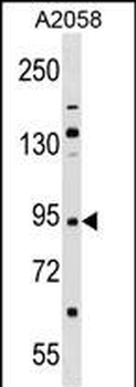TRIM42 Antibody (Center)