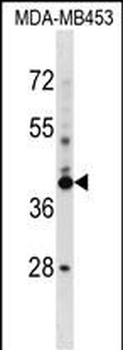 SRRD Antibody (Center)
