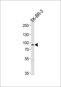 MTIF2 Antibody (N-term)