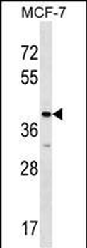 MRPL1 Antibody (N-term)