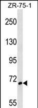 SH3BP1 Antibody (Center)