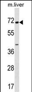 CPNE6 Antibody (N-term)