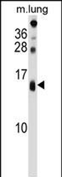 DEXI Antibody (C-term)