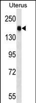 CGNL1 Antibody (N-term)