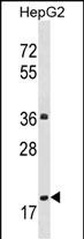 PPM1M Antibody (Center)