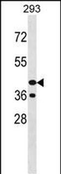 PNCK Antibody (C-term)