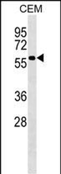 PI4K2A Antibody (C-term)
