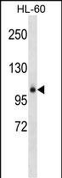 GPLD1 Antibody (Center)