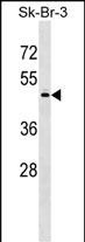 POLS Antibody (Center)