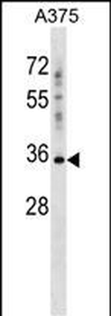 PSG2 Antibody (C-term)
