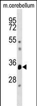 DUSP12 Antibody (Center)