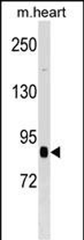 CUL2 Antibody (N-term)