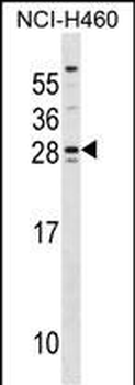 SH3BGR Antibody (Center)