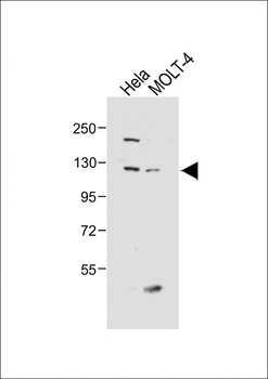 SEMA6D Antibody (N-term)