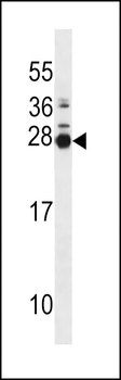 MOL2B Antibody (N-term)