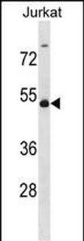 WTAP Antibody (C-term)