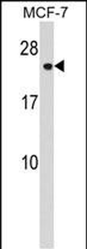 CHMP1A Antibody (N-term)