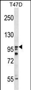 HPS3 Antibody (N-term)