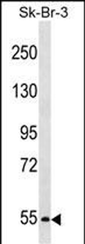 PCSK4 Antibody (N-term)