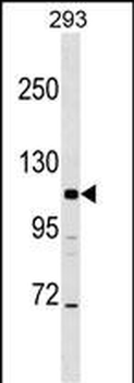 AP3B2 Antibody (N-term)