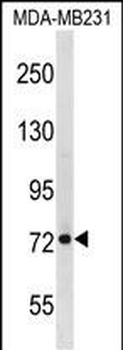 RMI1 Antibody (N-term)