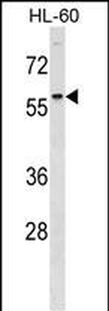 DCDC2 Antibody (Center)