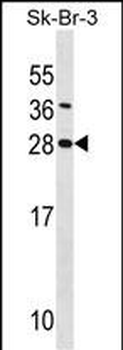 SDC4 Antibody (Center)