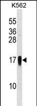 CCL7 Antibody (Center)