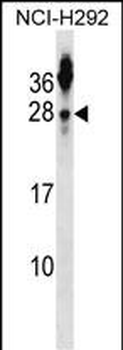 TSPAN2 Antibody (N-term)