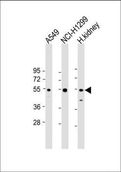 GCNT3 Antibody (N-term)