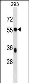 BSDC1 Antibody (C-term)
